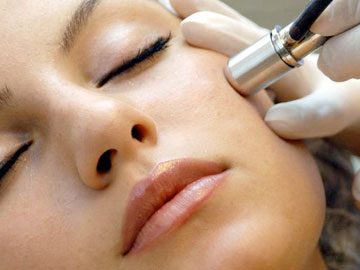 Microdermabrasion